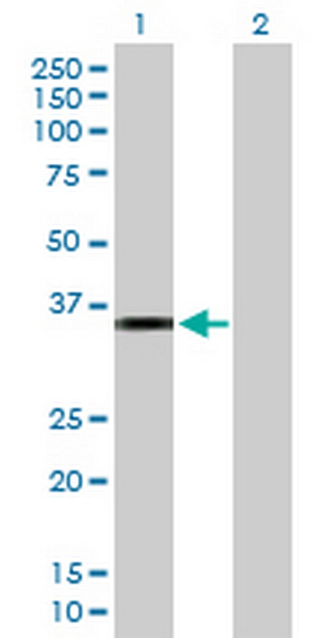 CRHBP Antibody in Western Blot (WB)