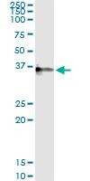 CRHBP Antibody in Immunoprecipitation (IP)