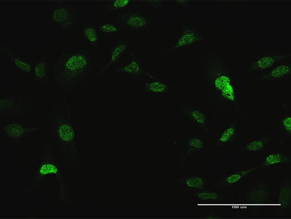 CRKL Antibody in Immunocytochemistry (ICC/IF)