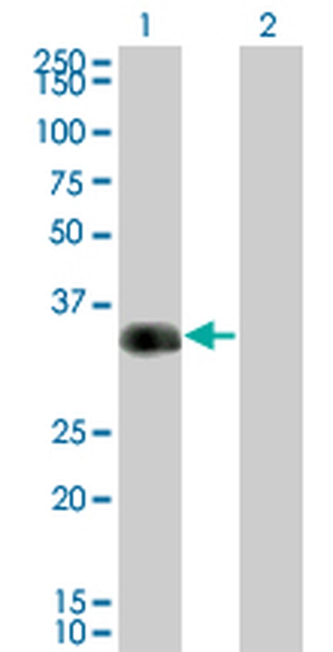 CRX Antibody in Western Blot (WB)