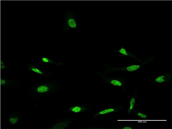 CRX Antibody in Immunocytochemistry (ICC/IF)