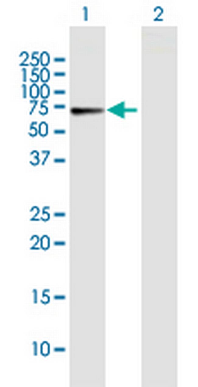 CRY1 Antibody in Western Blot (WB)