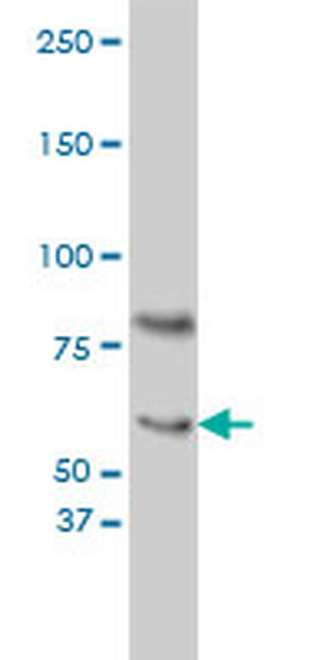 CRY1 Antibody in Western Blot (WB)