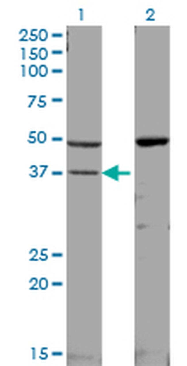 MAPK14 Antibody in Western Blot (WB)