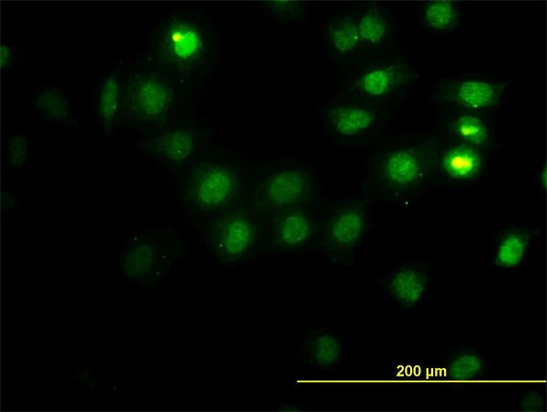 CSE1L Antibody in Immunocytochemistry (ICC/IF)