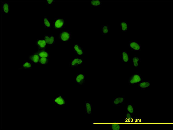 CSE1L Antibody in Immunocytochemistry (ICC/IF)