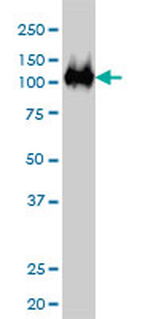 CSE1L Antibody in Western Blot (WB)