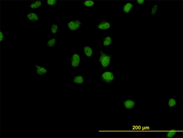 CSE1L Antibody in Immunocytochemistry (ICC/IF)