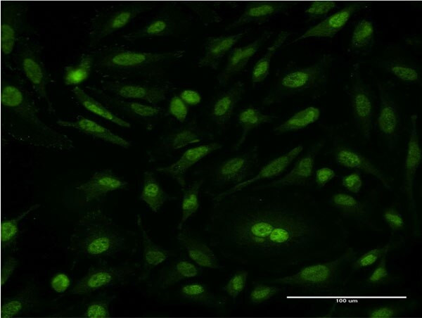 CSE1L Antibody in Immunocytochemistry (ICC/IF)