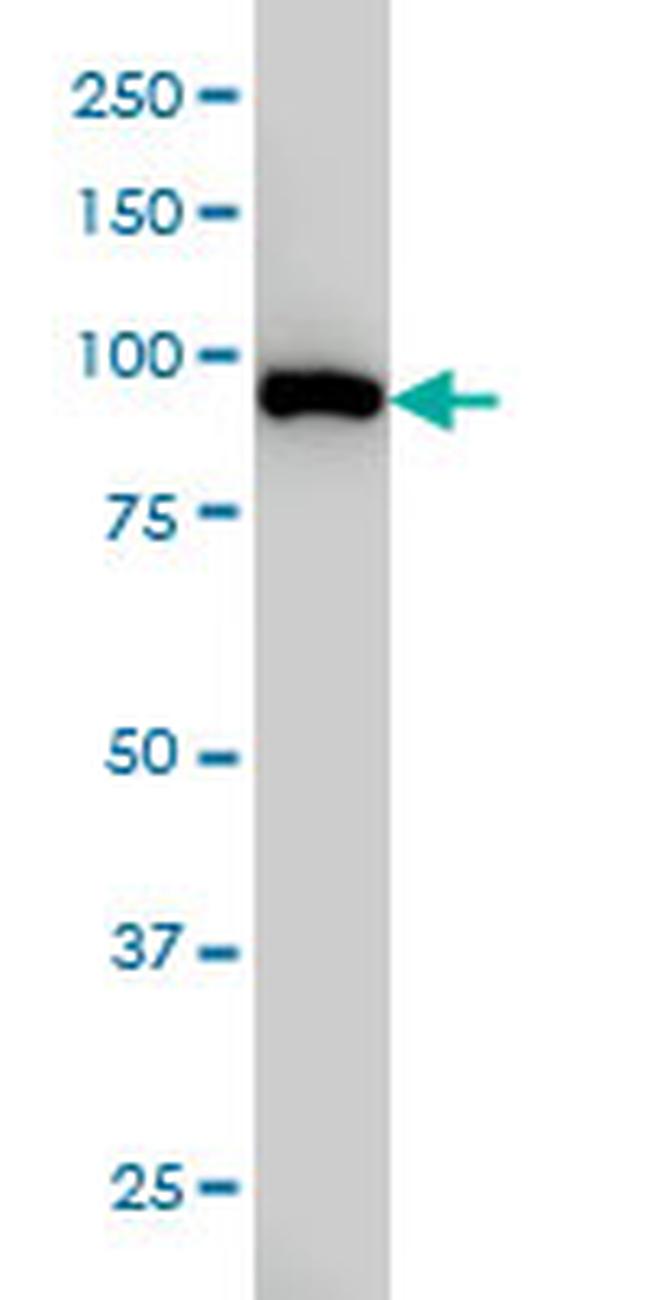 CSE1L Antibody in Western Blot (WB)