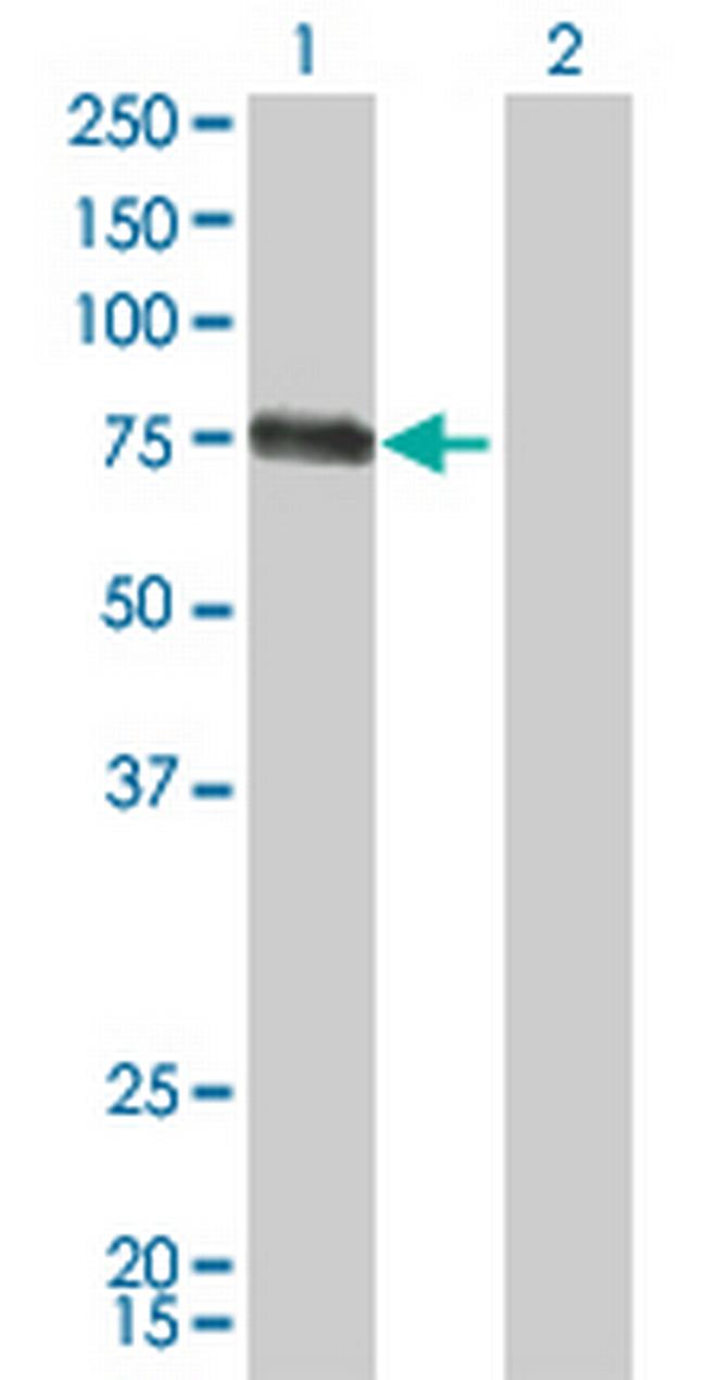 CSF1 Antibody in Western Blot (WB)