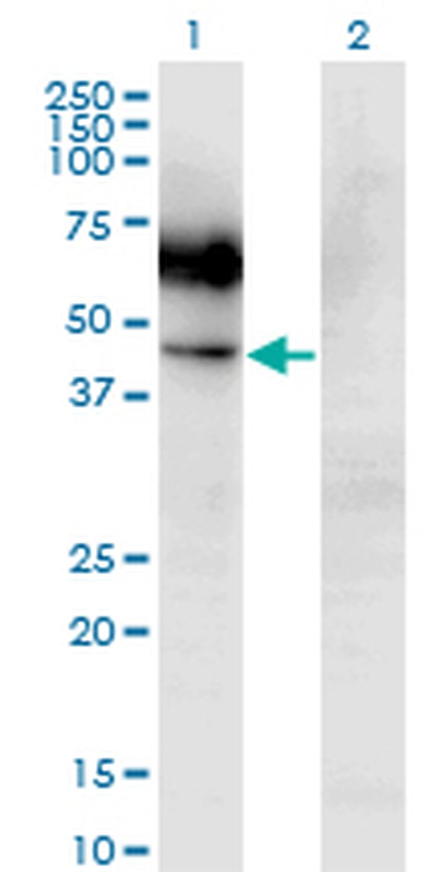 CSF2RA Antibody in Western Blot (WB)