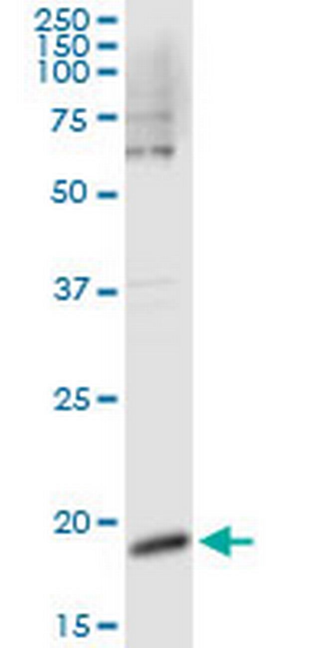 CSF3 Antibody in Immunoprecipitation (IP)