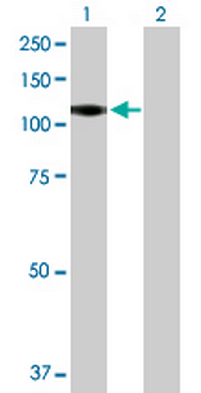 CSF3R Antibody in Western Blot (WB)