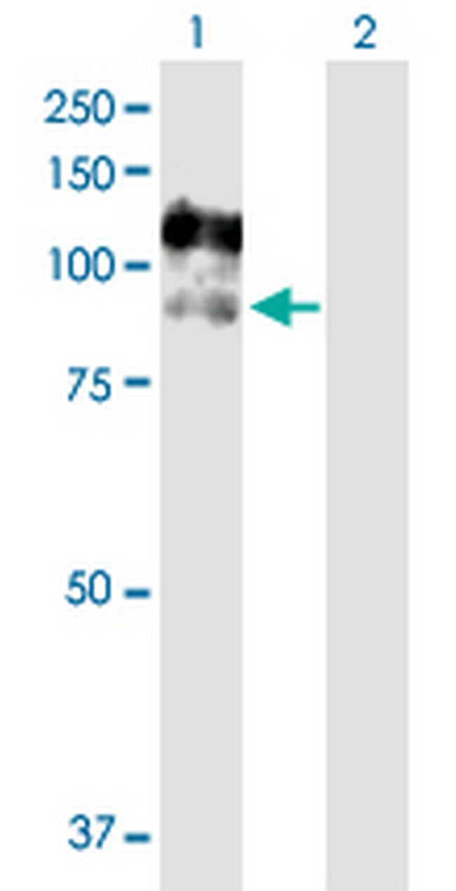 CSF3R Antibody in Western Blot (WB)