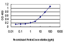 CSK Antibody in ELISA (ELISA)