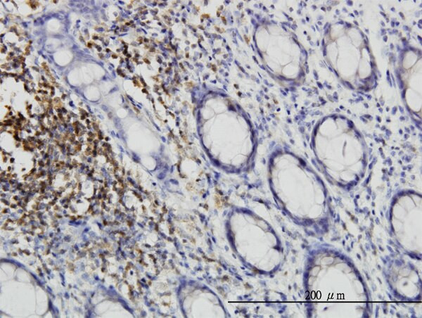 CSK Antibody in Immunohistochemistry (Paraffin) (IHC (P))