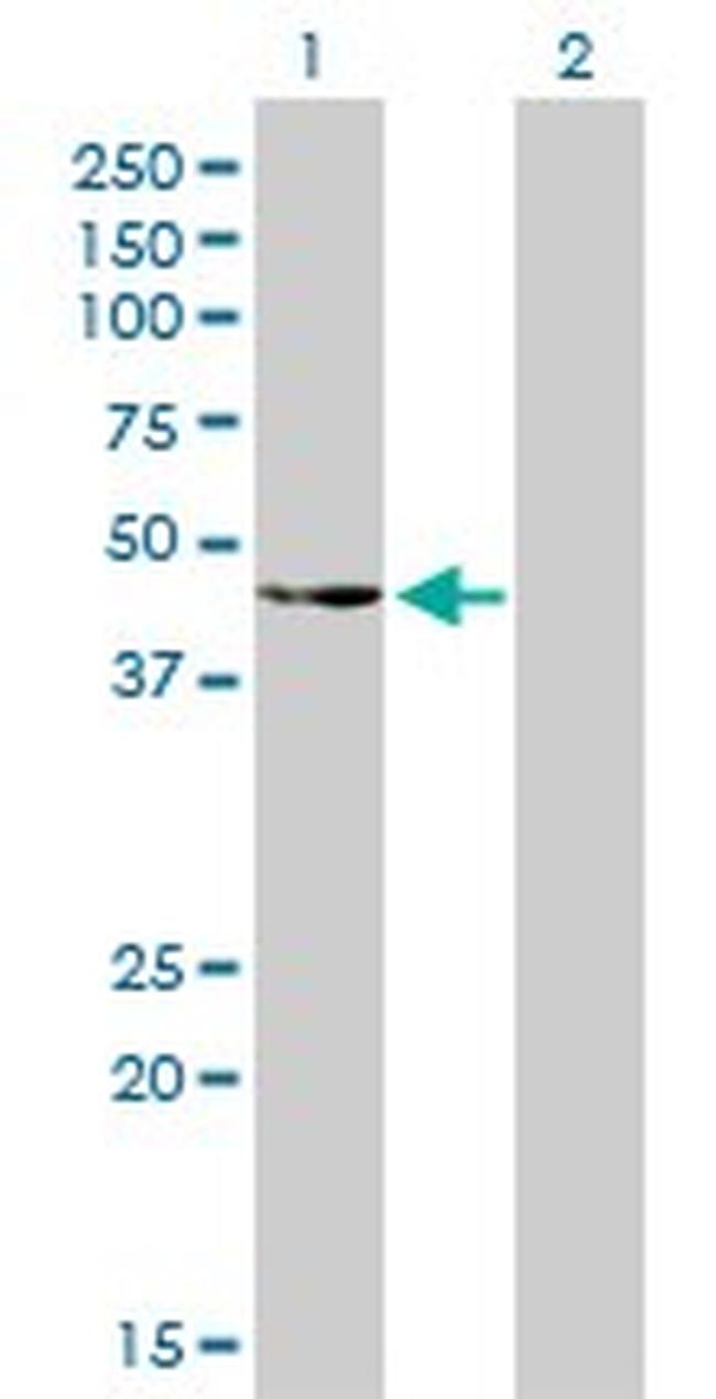 CSK Antibody in Western Blot (WB)