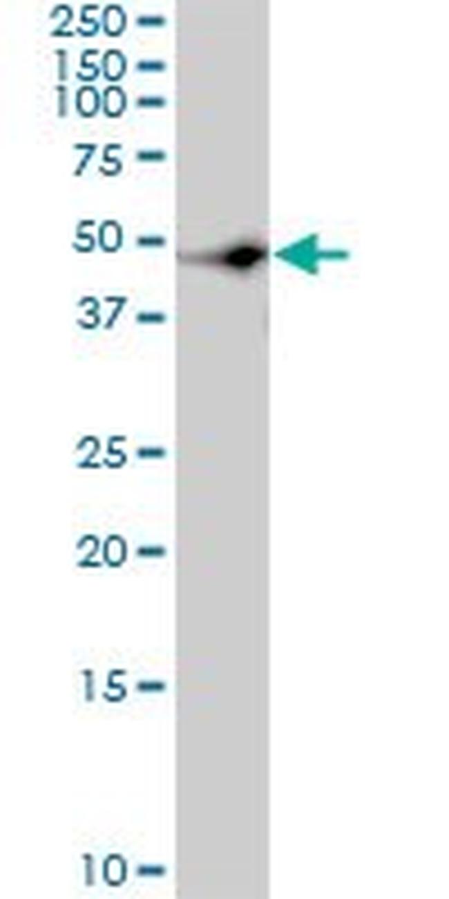 CSK Antibody in Western Blot (WB)