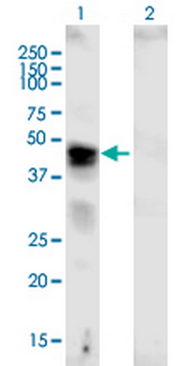 VCAN Antibody in Western Blot (WB)