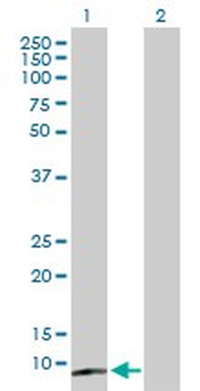 CST5 Antibody in Western Blot (WB)