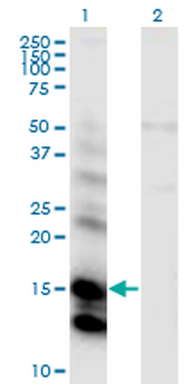 CST6 Antibody in Western Blot (WB)