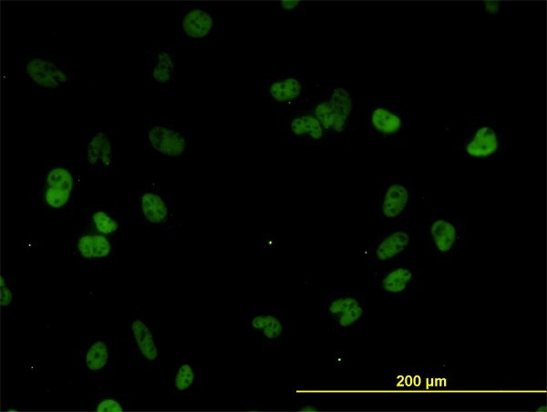 CSTF3 Antibody in Immunocytochemistry (ICC/IF)