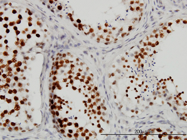 CSTF3 Antibody in Immunohistochemistry (Paraffin) (IHC (P))