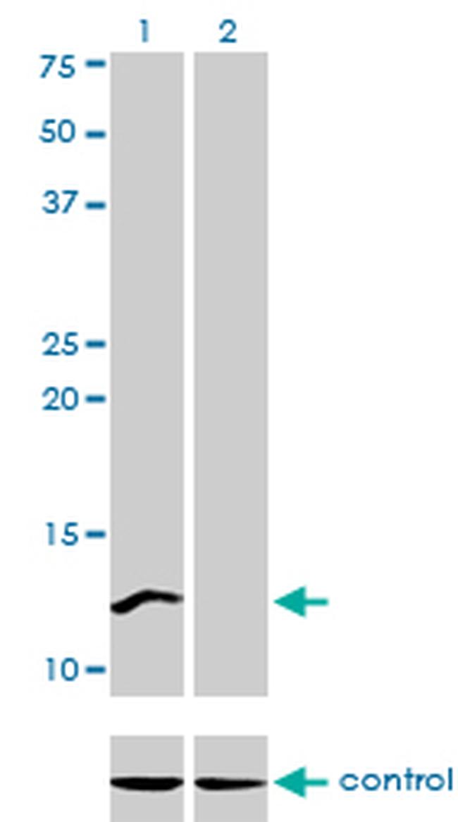 CSTF3 Antibody in Western Blot (WB)