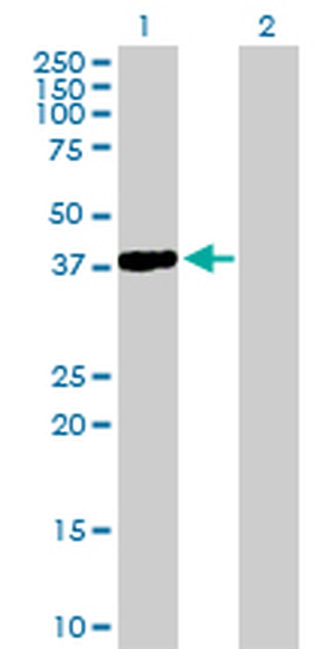 NKX2-5 Antibody in Western Blot (WB)