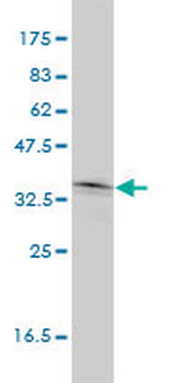 NKX2-5 Antibody in Western Blot (WB)