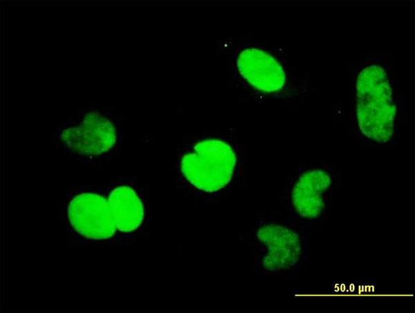 CTBP1 Antibody in Immunocytochemistry (ICC/IF)