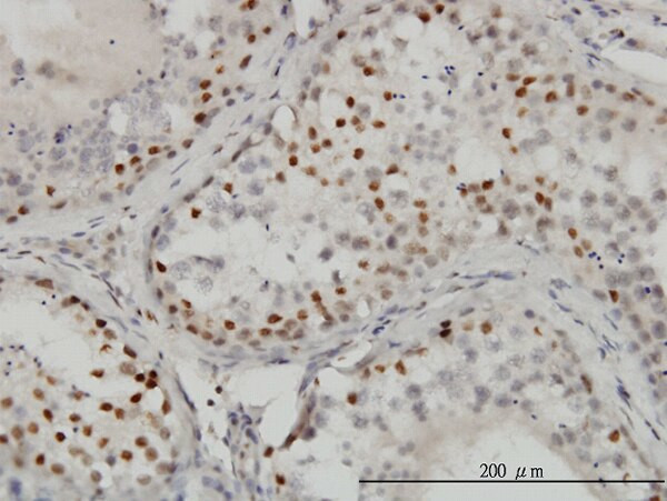 CTBP1 Antibody in Immunohistochemistry (Paraffin) (IHC (P))