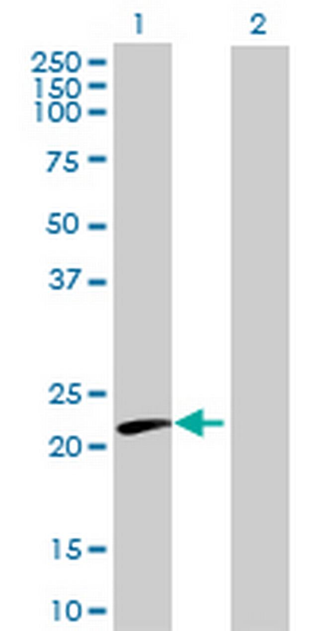 CTF1 Antibody in Western Blot (WB)