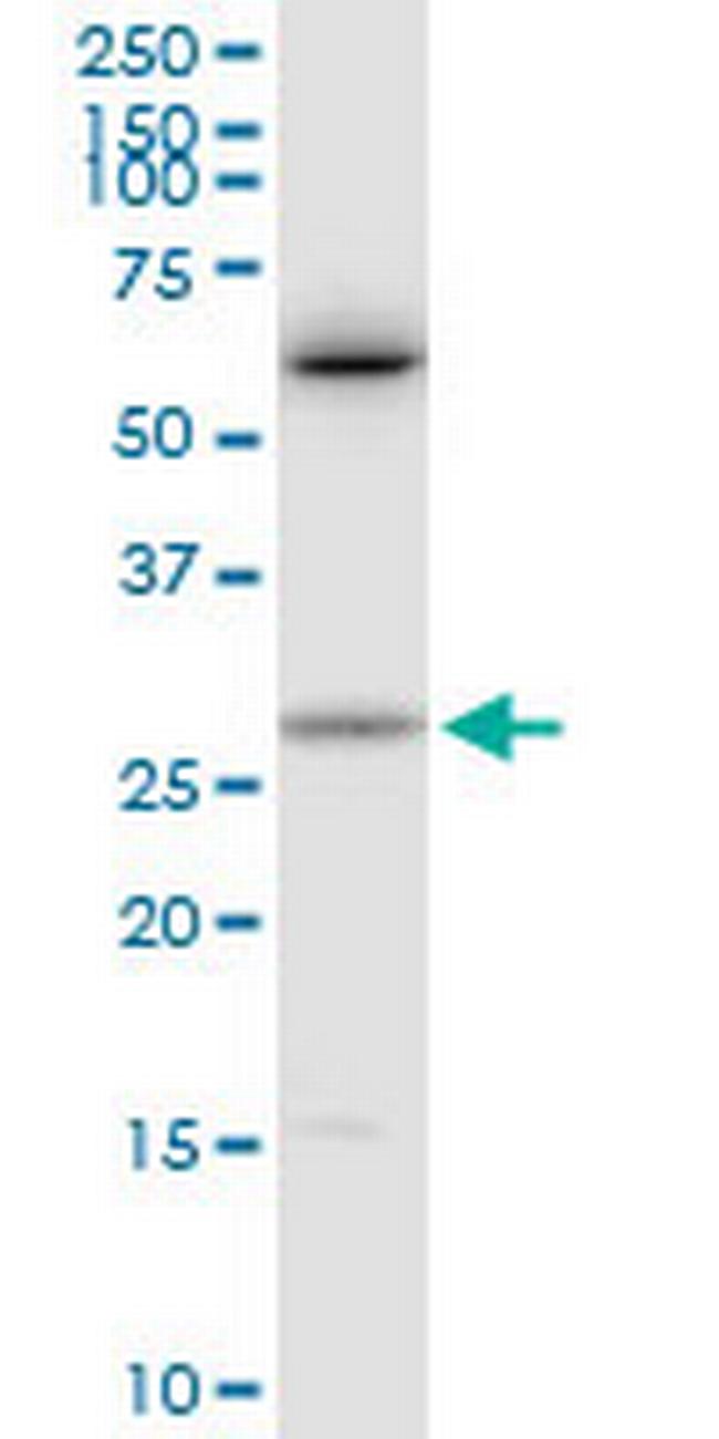 CTF1 Antibody in Western Blot (WB)