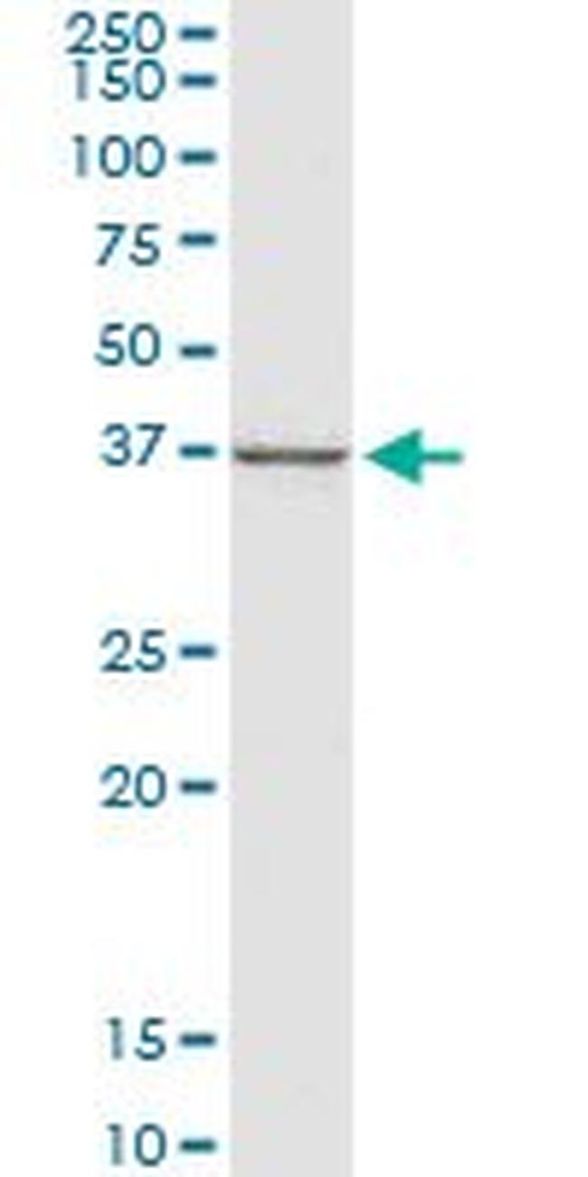 CTGF Antibody in Western Blot (WB)