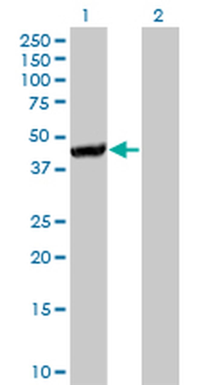 CTH Antibody in Western Blot (WB)