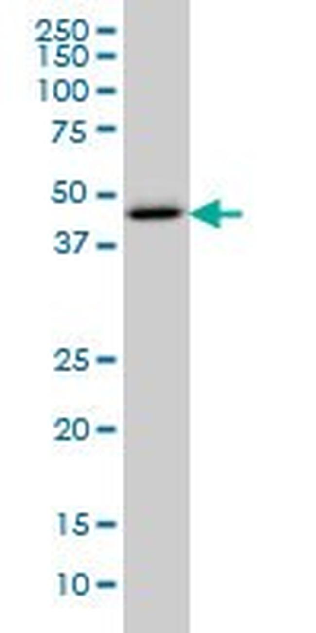 CTH Antibody in Western Blot (WB)