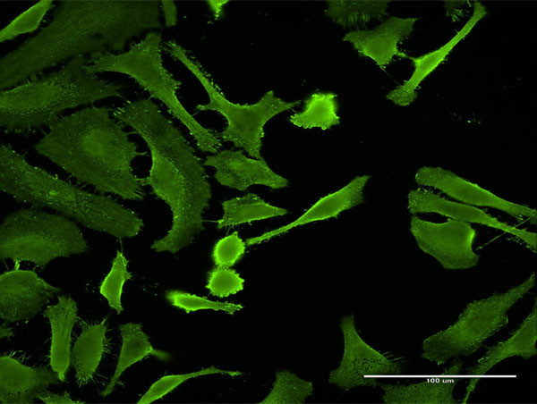 CTLA4 Antibody in Immunocytochemistry (ICC/IF)