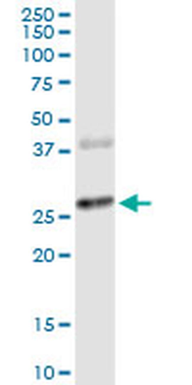 CTLA4 Antibody in Western Blot (WB)