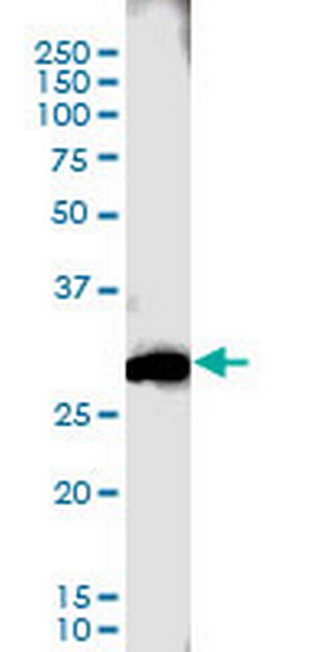 CTLA4 Antibody in Western Blot (WB)