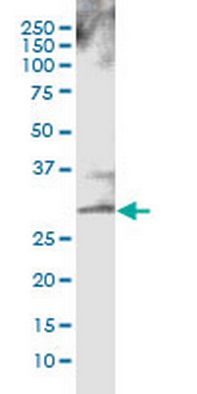 CTLA4 Antibody in Western Blot (WB)