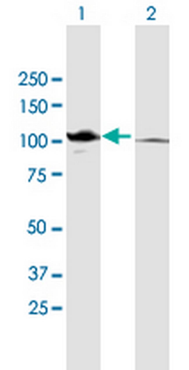 CTNNA2 Antibody in Western Blot (WB)