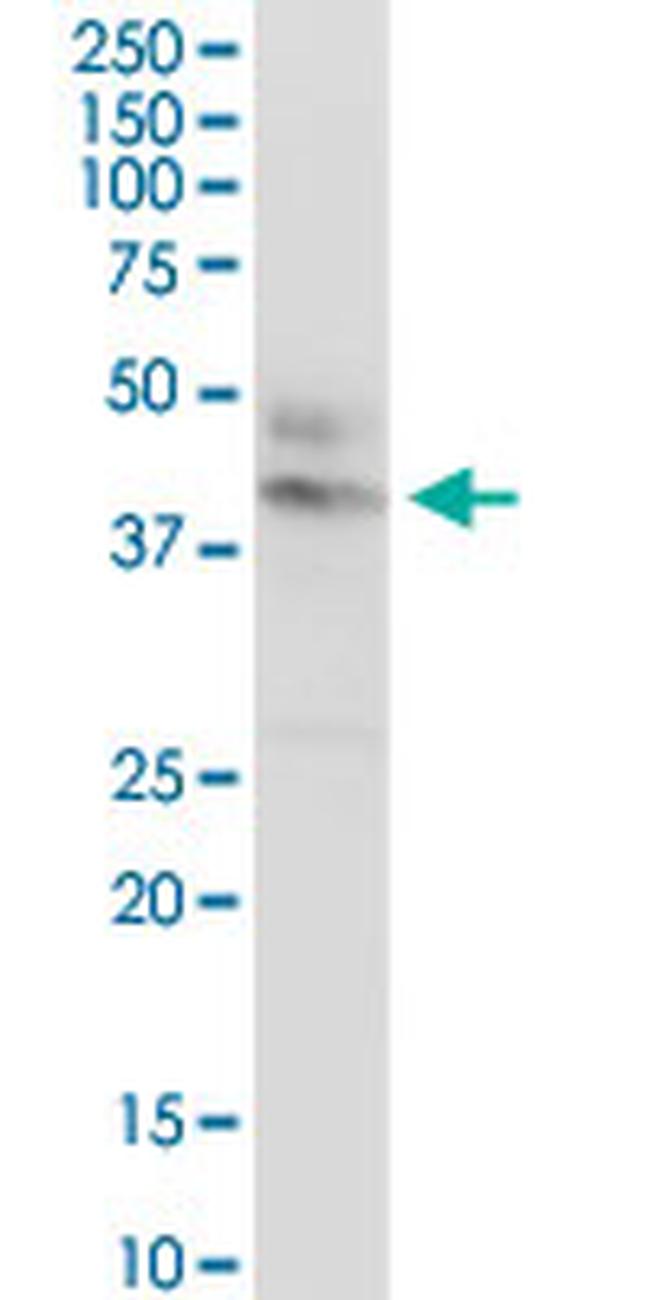 CTNS Antibody in Western Blot (WB)