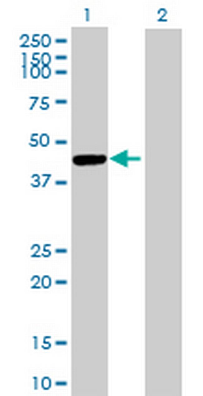 CTSE Antibody in Western Blot (WB)