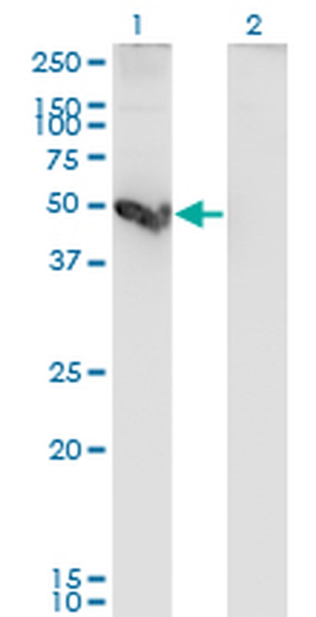 CTSE Antibody in Western Blot (WB)