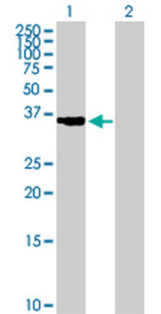 CTSK Antibody in Western Blot (WB)