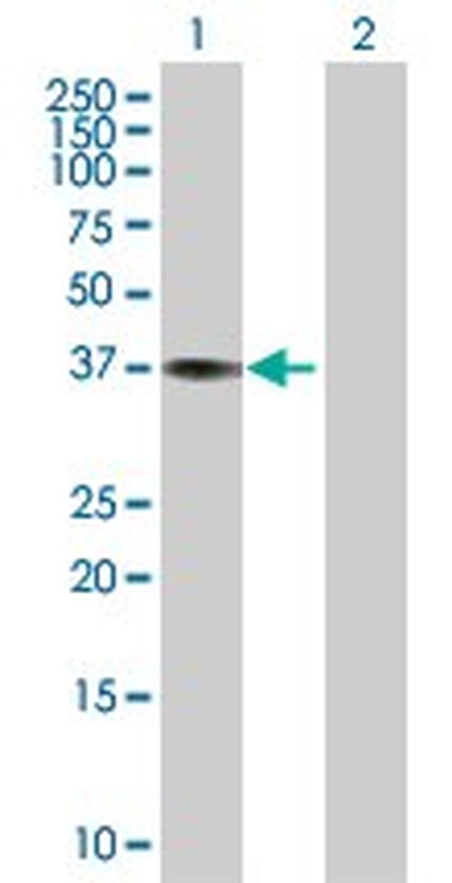 CTSK Antibody in Western Blot (WB)