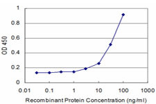 CTSK Antibody in ELISA (ELISA)