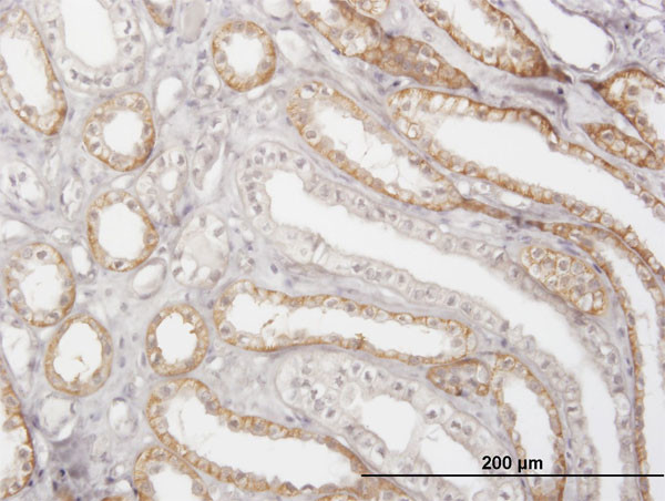 CTSK Antibody in Immunohistochemistry (Paraffin) (IHC (P))